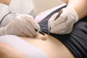 Can Electrolysis Laser Hair Removal Give You Perfect Hair-Free Skin Instantly