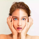 Glutathione IV Drip and Anti Aging Does It Really Work