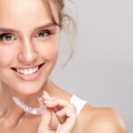 Dental Aligners in Dubai 20