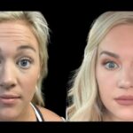 The Role of Expertise in Botox Treatments at Best Aesthetic Clinics in Dubai