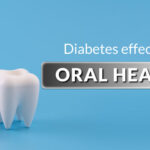 How Diabetes Affects Your Oral Health 3 How Diabetes Affects Your Oral Health