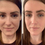 PRP Treatment in Dubai Enhancing Cellular Hair Performance