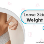 Loose Skin after weight loss