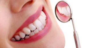 Affordable Scaling and Polishing in Dubai