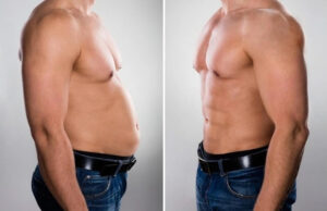 Six Pack Liposuction vs Gym: What Works Better in Dubai? 1 Six Pack Liposuction vs Gym: What Works Better in Dubai?