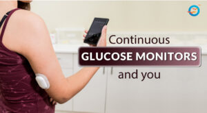 Continuous Glucose Monitors – Things You Need to Know Before Use