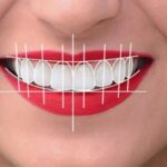 Digital Smile Design in Ghatkopar: Transform Your Smile at OM Datta Dental Clinic