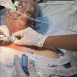 Critical Airway Emergencies Demand FONA Expertise: Here’s Why 5 Critical Airway Emergencies Demand FONA Expertise: Here’s Why