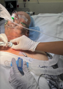 Critical Airway Emergencies Demand FONA Expertise: Here’s Why