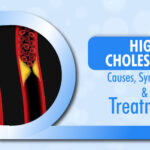 High Cholesterol: Symptoms, Causes and Treatment 2 High Cholesterol: Symptoms, Causes and Treatment