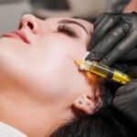 PRP Microneedling Toronto