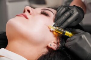Is PRP Microneedling Toronto Worth It? 10 Key Questions