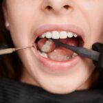 Why Most People Delay a Root Canal-and What It Ends Up Costing Them