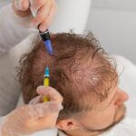 How Long Does Hair Fall Treatment Take to Show Results?