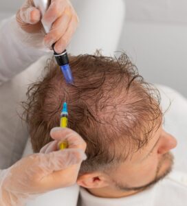 How Long Does Hair Fall Treatment Take to Show Results?