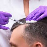 How Successful Are Modern Hair Transplant Procedures?