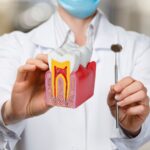 Root Canal Specialist Dubai: Complete Patient Guide