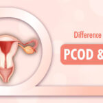 difference between PCOD PCOS 1