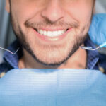 Teeth Whitening Cost in Dubai 8