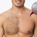 WhatsApp Image 2025 04 28 at 6.38.56 PMboday hair transplant