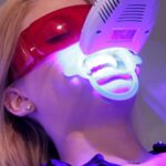Teeth Whitening Cost in Dubai 7