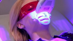 Teeth Whitening in Dubai: Bright Smile Solutions