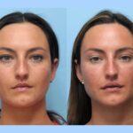 Best Plastic Surgeons in Dubai Delivering Subtle Youthful Results with Thread Lift