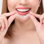 Dental Braces in Dubai: Best Clinics & Experts