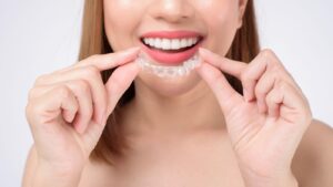 Dental Braces in Dubai: Best Clinics & Experts