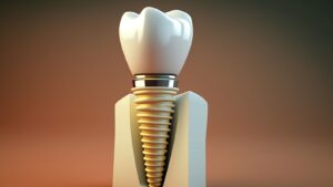 Dental Implant Cost In Dubai Insurance Coverage Guide