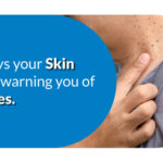 Skin warning of diabetes