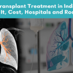 Lung Transplant Treatment in India: Who Needs It, Cost, Hospitals and Recovery