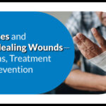 Diabetes and wound healing 1 1