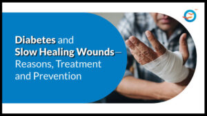 Diabetes and Wound Healing: Reasons, Treatment and Prevention 1 Diabetes and Wound Healing: Reasons, Treatment and Prevention