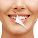 Teeth Whitening in Dubai: Top Methods Explained