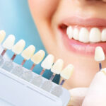 Dental Tooth Removal In Dubai Healing Process Tips 3 Dental Tooth Removal In Dubai Healing Process Tips