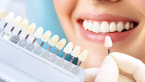 Dental Tooth Removal In Dubai Healing Process Tips