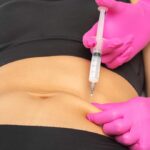 Lipolysis