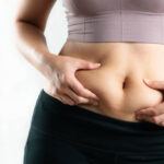 What Are the Best Professional Treatments for Belly Fat?