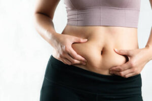 What Are the Best Professional Treatments for Belly Fat?
