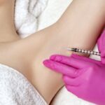 Botox for Sweating 1200