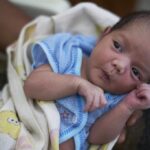 Which Congenital Anomalies Are Detected in Ultrasound? 3 Which Congenital Anomalies Are Detected in Ultrasound?