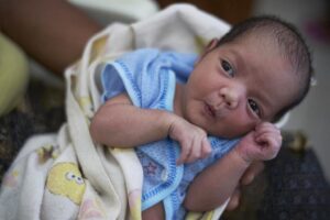 Which Congenital Anomalies Are Detected in Ultrasound?