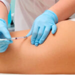 Do Butt Fillers Provide Natural-Looking Enhancement?