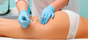 Do Butt Fillers Provide Natural-Looking Enhancement?