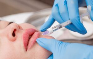 How Safe Is Juvederm Filler for First-Time Users?