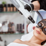 Why Laser Carbon Peel Fits Perfectly Into a Busy Lifestyle