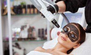 Why Laser Carbon Peel Fits Perfectly Into a Busy Lifestyle