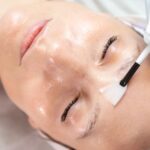 Chemical Peels In Dubai1