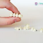 How Much Do Dental Crowns and Bridges Cost?